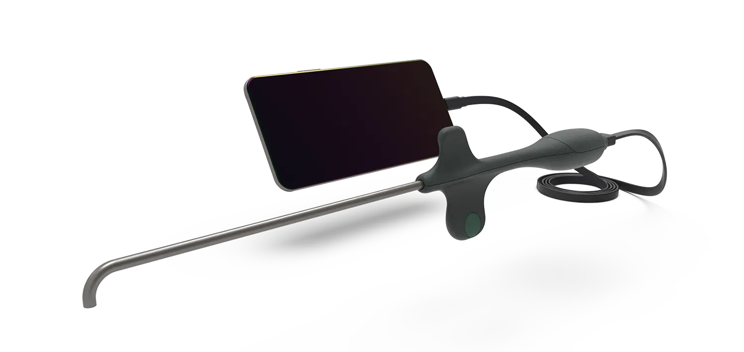 Sibbo Periscope – the smartphone laryngoscope