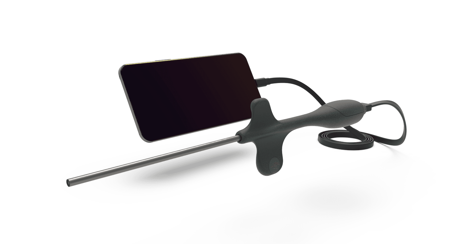 Smartphone endoscope with flexible probe.