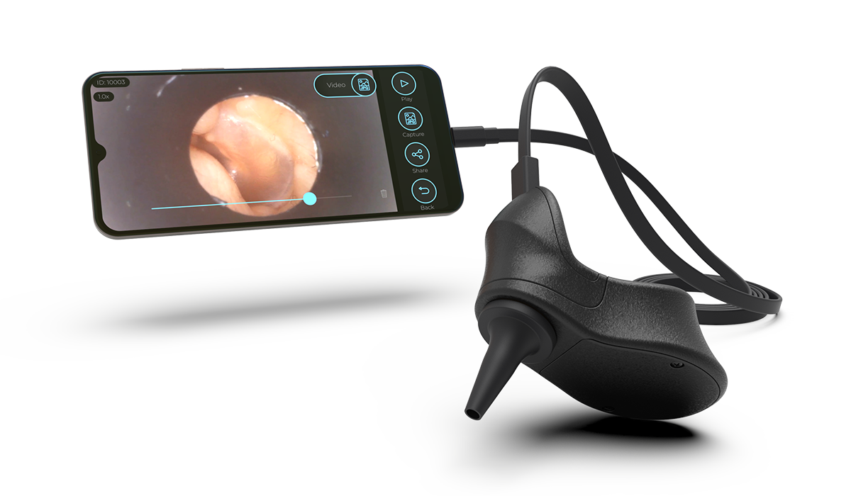 EarPenguin-otoscope-Phone