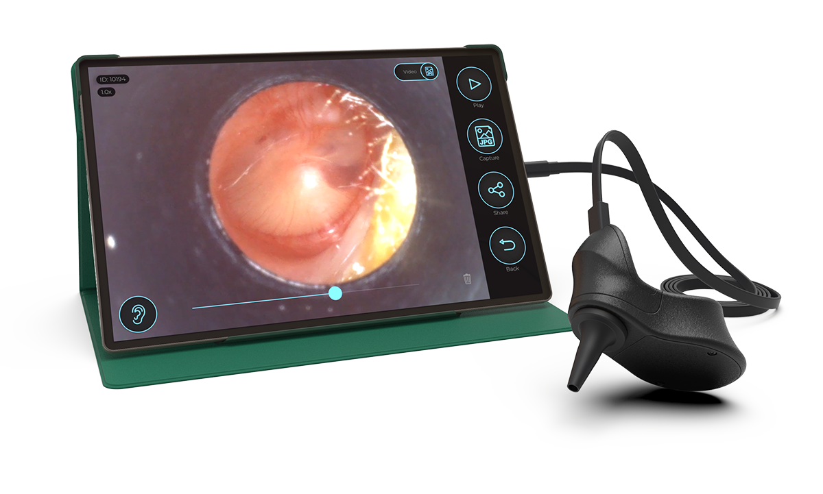 EarPenguin-otoscope-Phone
