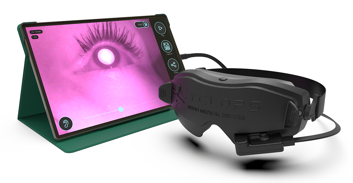 Sibbo Cyclops portable nystagmus goggles with TAB