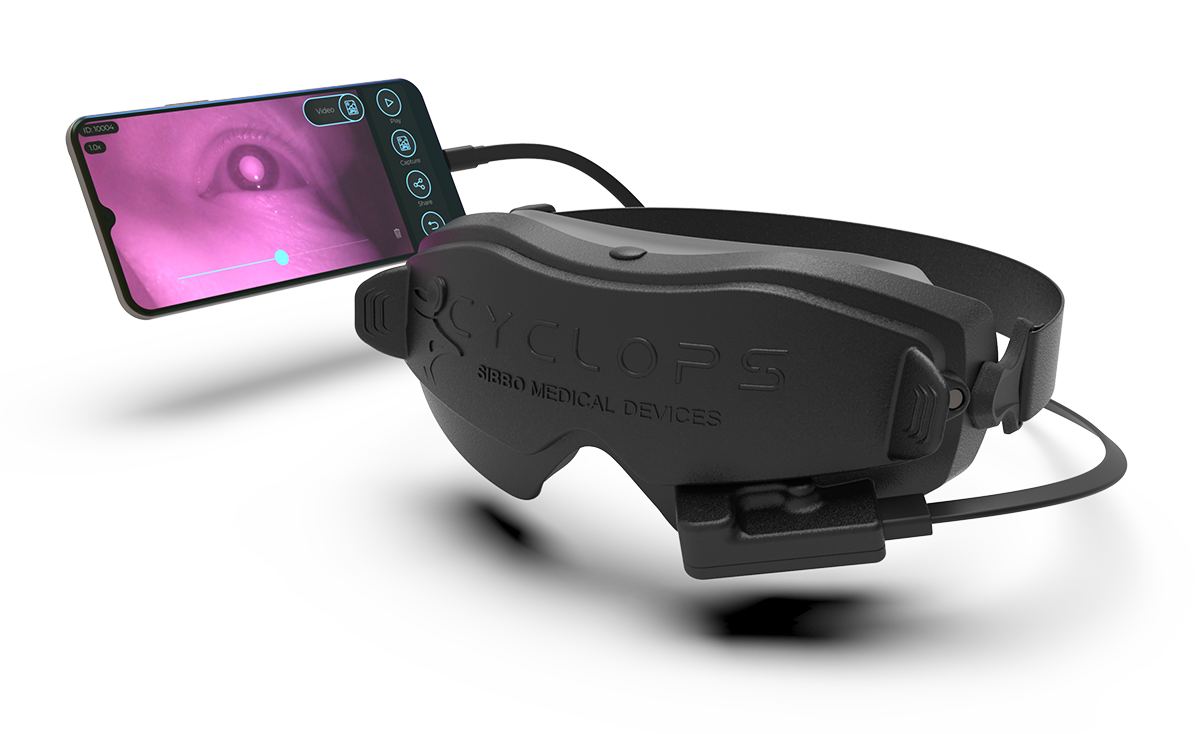 Sibbo Cyclops portable nystagmus goggles with phone