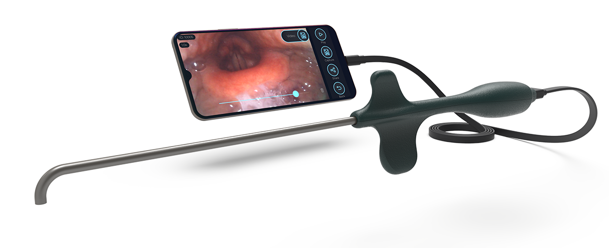 Sibbo Periscope Phone