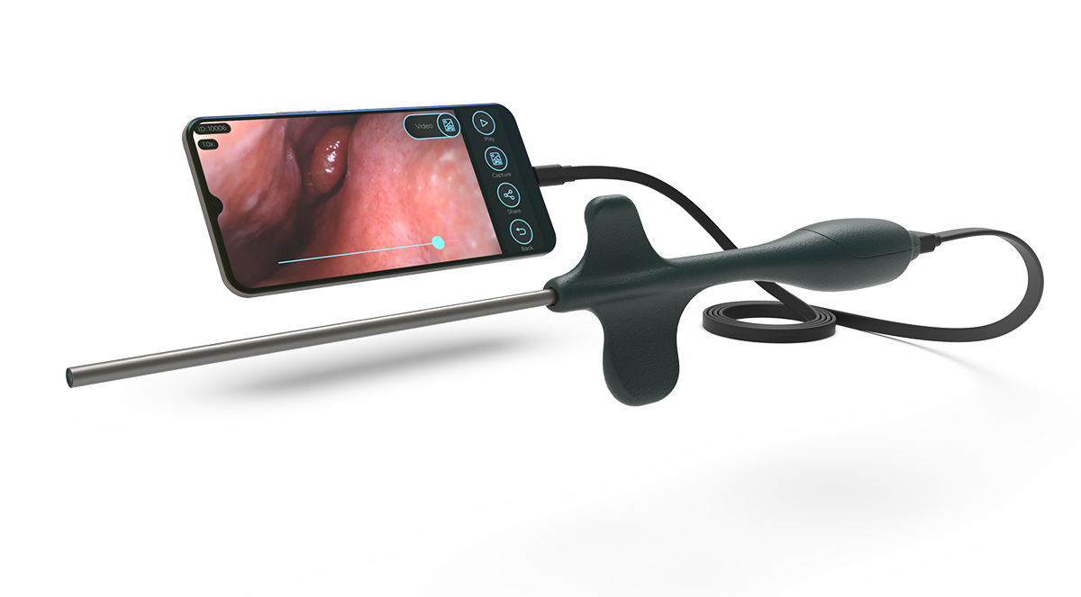 Sibbo Rhinoscope Phone