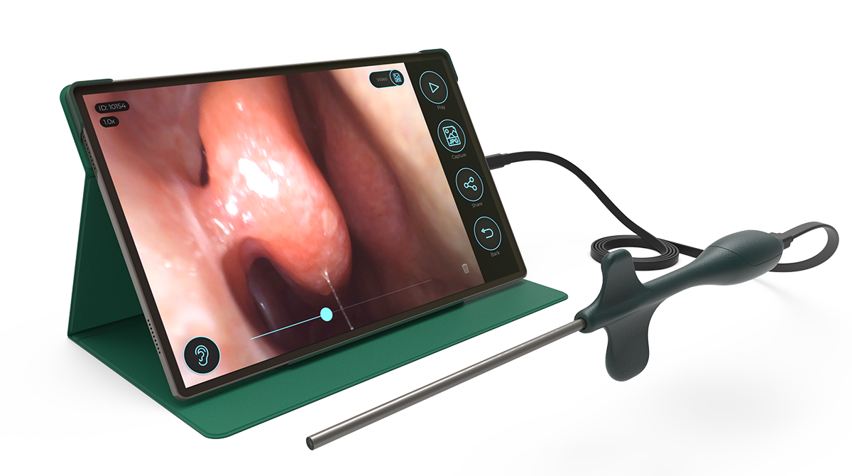 Sibbo Rhinoscope Tablet